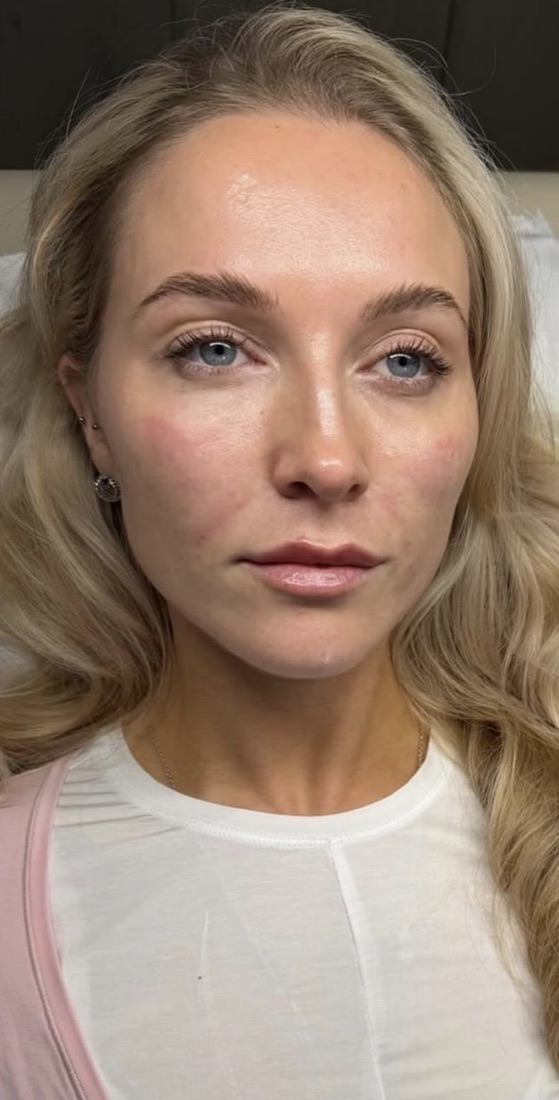 Skin after — refined tone and hydration