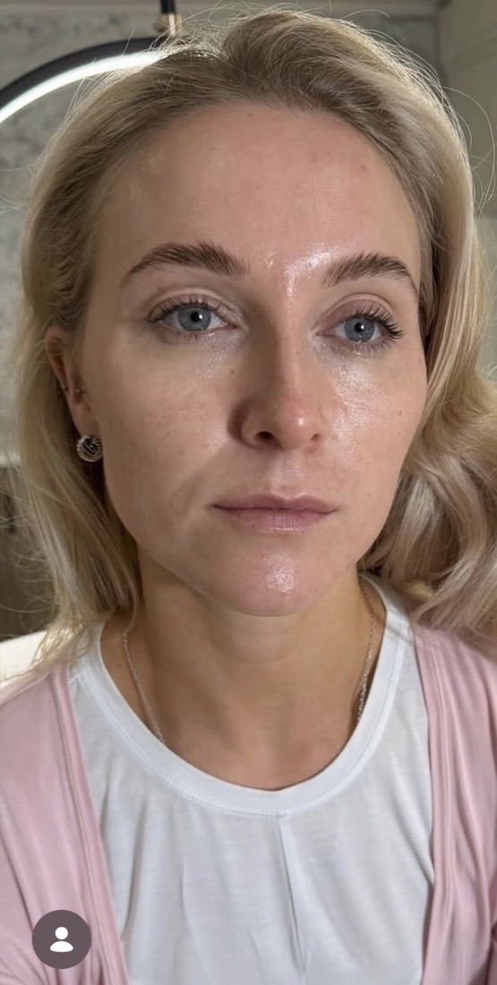 Skin before — tired, uneven tone